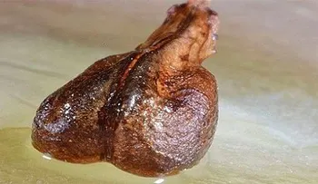 ¡Todo 1 siglo oculto! Semilla que los médicos no quieren conozcas ¡Destruye el cáncer!