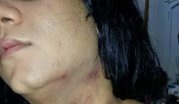 Denuncian policías golpean y dejan inconsciente a una transexual