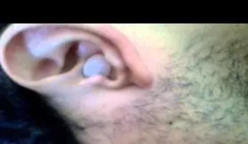 Remedios populares para quitar cerumen o cera en los oídos 