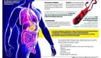 Conoce el mejor tratamiento para liberar tu estómago de bacteria Helicobacter Pylori