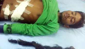 Operan a joven por dolor en el estómago y se impactan por lo que encuentran