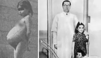 Conoce la increíble pero real historia de Lina Medina: la niña que fue madre a los 5 años