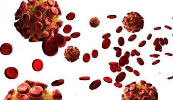 Como prevenir la toxoplasmosis
