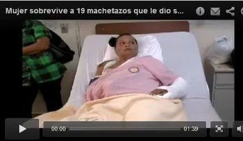 Video: mujer en la Vega cuenta como sobrevivio a 19 machetazos a manos de su Expareja