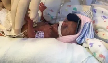 Niña que pesó al nacer 368 gramos recibe el alta después de cuatro meses