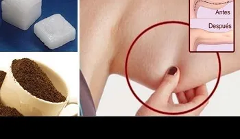 Esto es muy simple: elimina y olvídate de la flacidez en los brazos con café y alcanfor