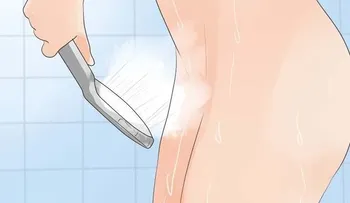 La candidiasis vaginal: Estas son las causas, síntomas y tratamiento