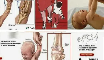 Mira porque es peligroso levantar a los niños por los brazos
