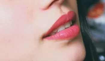 ¿Labios partidos rápido? Aquí te decimos cómo curarlos