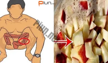 Limpia tu colon y pierde 10 kilos en 3 semanas con este remedio. Sorprendente!