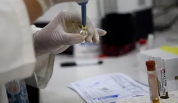 Nuevos lineamientos de la OMS para evitar transmisión sexual del zika