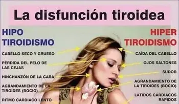 Revelan el secreto mejor guardado en el MUNDO; con esto se cura la tiroides; es un simple remedio