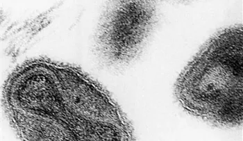 EEUU: Hallan frascos con virus de la viruela