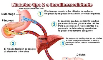 Detectan una posible diana terapéutica para tratar la diabetes tipo 2