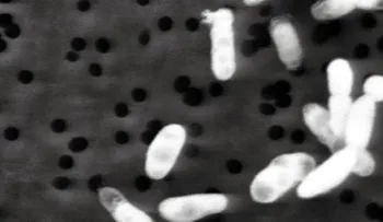 "Es casi demasiado tarde para evitar que haya una superbacteria resistente a los antibióticos