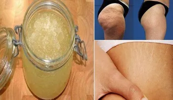 Eficaz exfoliante casero a base de azucar y sal para eliminar las estrías y la celulitis