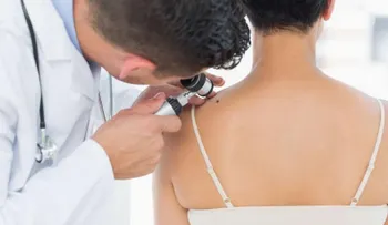 La visita al dermatólogo es esencial para el cuidado de la piel 