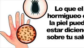 Si el hormigueo persiste debes ir rápido donde un médico: Que lo provoca y cómo curarlo?