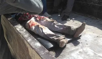 En Salinas trasladan pacientes en camión de basura por la falta de ambulancia