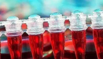 Una terapia celular controla un mieloma múltiple resistente a todos los tratamientos