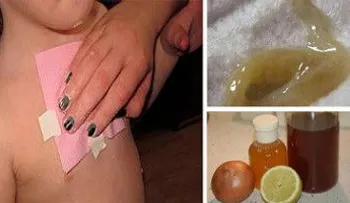 Elimina la tos y flemas de los pulmones en una sola noche
