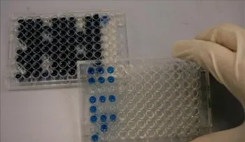 Médico cubano curado del ébola se recupera para volver a Sierra Leona