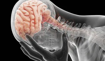 ¿Qué ocurre en un cerebro con depresión?