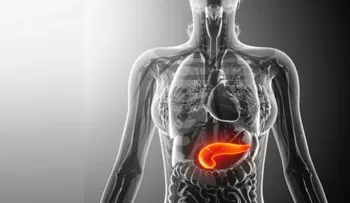 6 señales de que tienes cáncer de páncreas