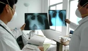  OMS plantea formula para reducir en 90 por ciento muertes por tuberculosis 