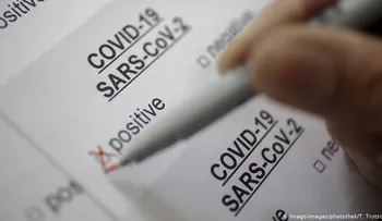 RD y otros países de Latinoamerica recibirán más de 1.3 millones de kits para detectar coronavirus 