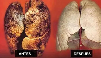 Cómo purificar tus pulmones en menos de 2 días 