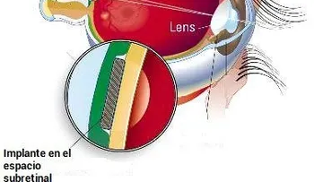 Cómo funciona la visión artificial, ¡Nadie te lo explicará mejor!
