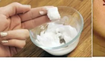 Prepara este remedio casero y elimina las manchas de tu piel rápidamente.