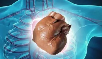 El chocolate disminuye la diabetes, enfermedades del hígado y ataques cardiacos...Descubrelo