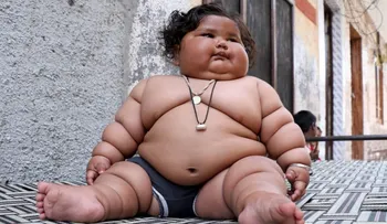 La bebé de 8 meses que pesa 17 kilos
