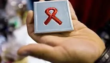 69% infectados de VIH en Nicaragua son jóvenes