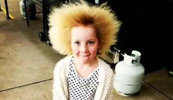 Una niña con una rara enfermedad que no puede ser peinada 