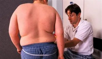Los niños de padres divorciados son más propensos a ser obesos, según estudio