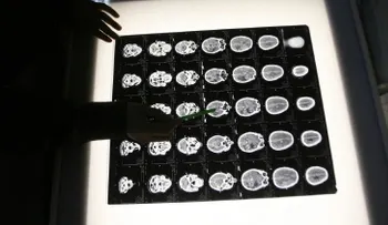 Un modelo matemático predice el desarrollo de los tumores cancerosos