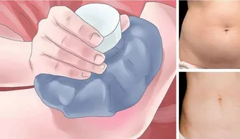 La terapia con hielo para quemar grasa: ¡Los Resultados son increíblemente muy rápidos!