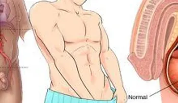 ¡Alerta de síntomas del cáncer testicular que no debes pasar por alto... Impresionante!