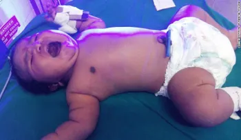 Esta podría ser la bebé más pesada de la India