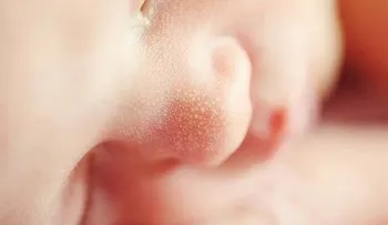 En Colombia nace bebé de más de 13 libras