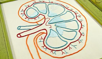 Acidosis tubular renal, ¿la "enfermedad de moda"?