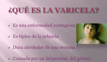 ¿Qué es la varicela, y qué hacer con esta enfermedad?