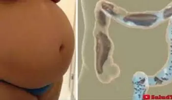 Los 10 mejores trucos caseros para eliminar la inflamación abdominal