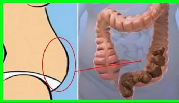 Una cucharada al día en ayunas puedes vaciar tu caca y limpiar tu intestino en dos minutos 