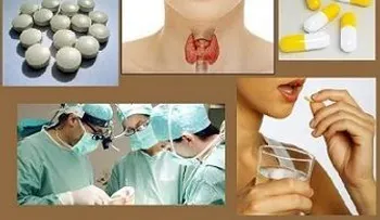 ¿Qué entendemos por hipertiroidismo?.Tratamiento