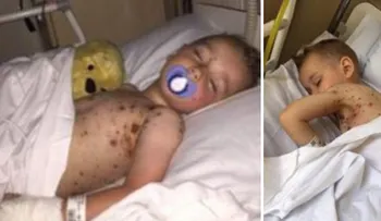 Un error de los médicos casi le cuesta la vida a este niño. ¡Todos los padres deben saberlo!