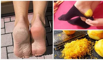 Descubre por qué deberías poner cáscara de limón en tus pies antes de ir a dormir